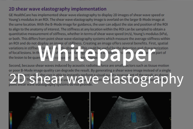 Whitepaper / 2D Shear Wave Elastography